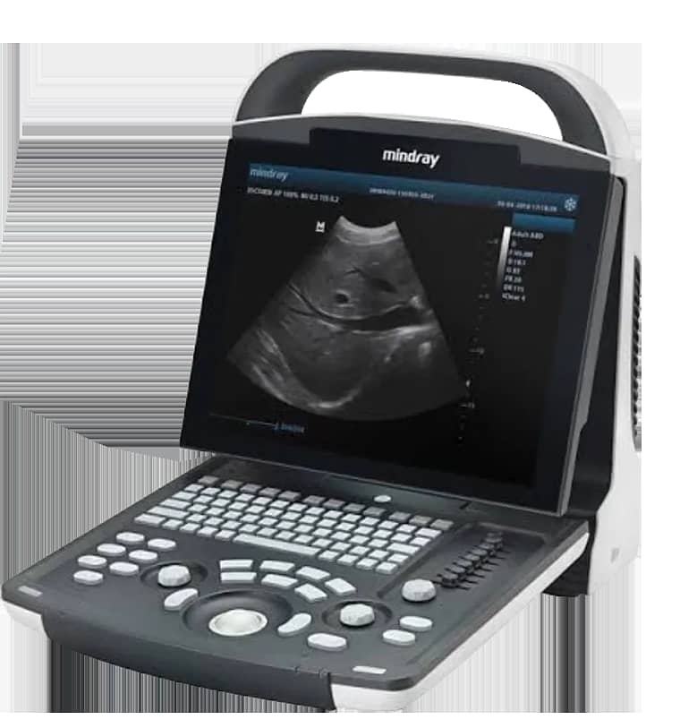 Ultrasound machine available of top brands in refurb and new condition 4