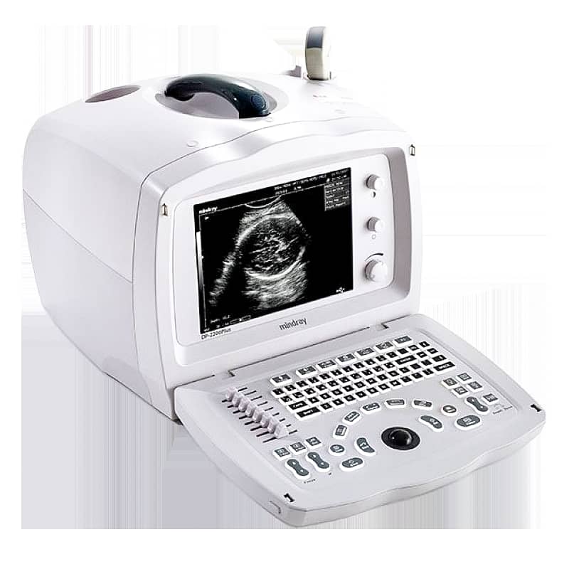 Ultrasound machine available of top brands in refurb and new condition 5