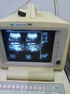 Ultrasound