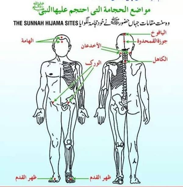 DKJ Hijama Cupping Therapy Medication Center   Clinic Doctor Hospital 3