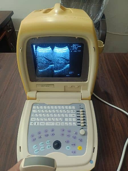 Ultrasound Machines 16