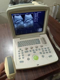 Ultrasound