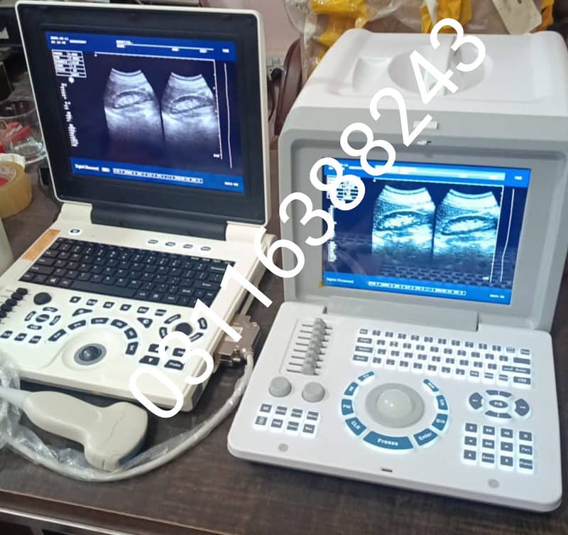 Ultrasound Machine 4