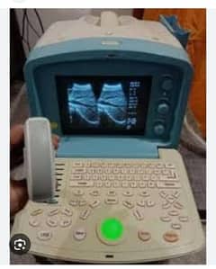 Ultrasound