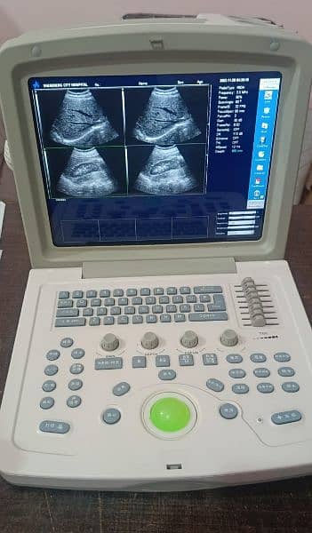 Ultrasound Machines 19