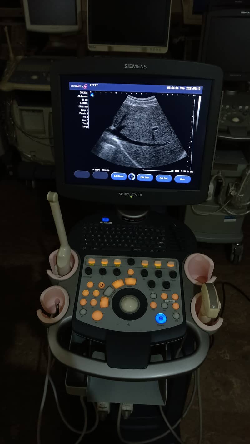 Siemens Sonovista FX Premium Edition Color Doppler Ultasound Machine 6