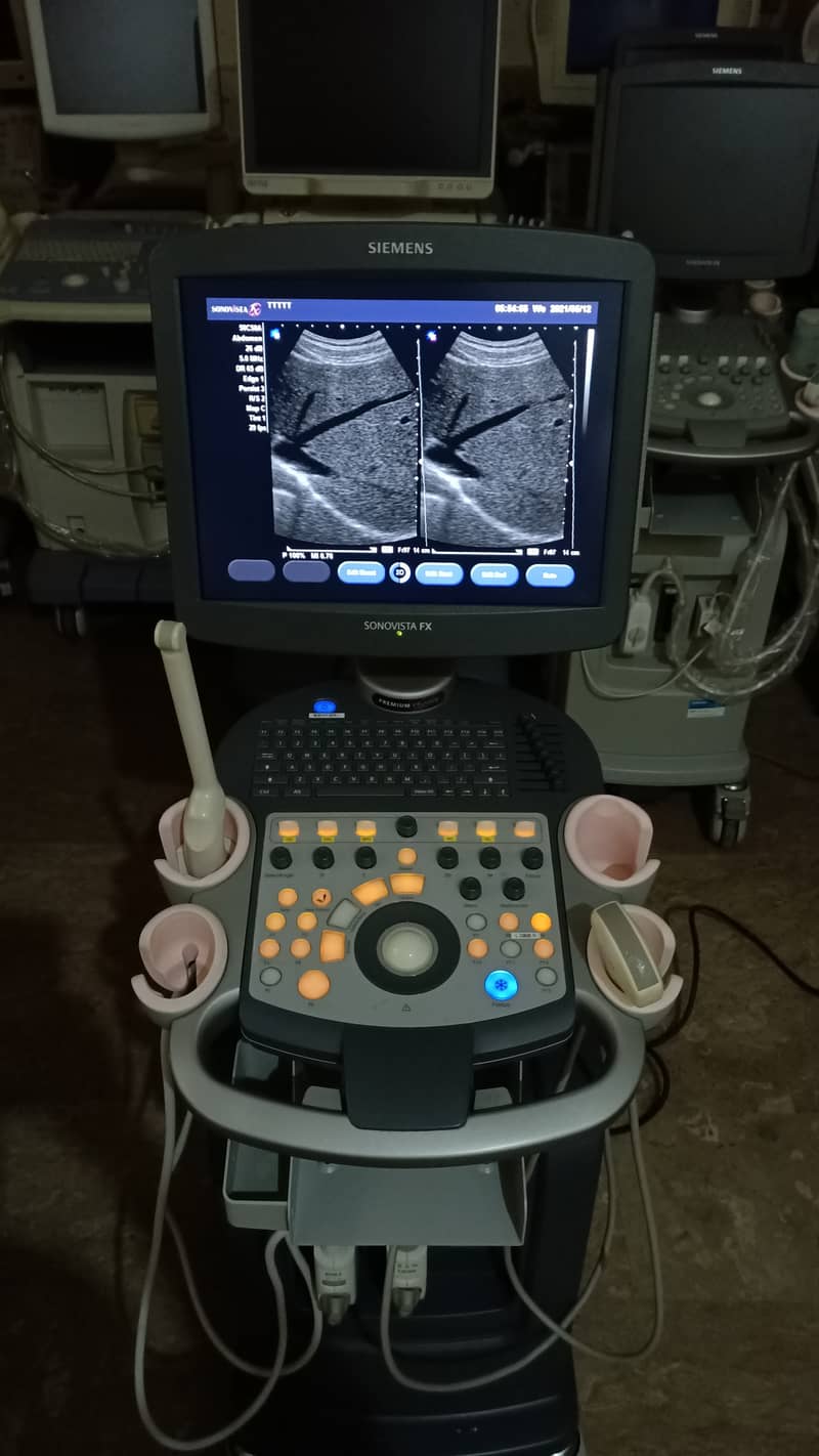 Siemens Sonovista FX Premium Edition Color Doppler Ultasound Machine 7