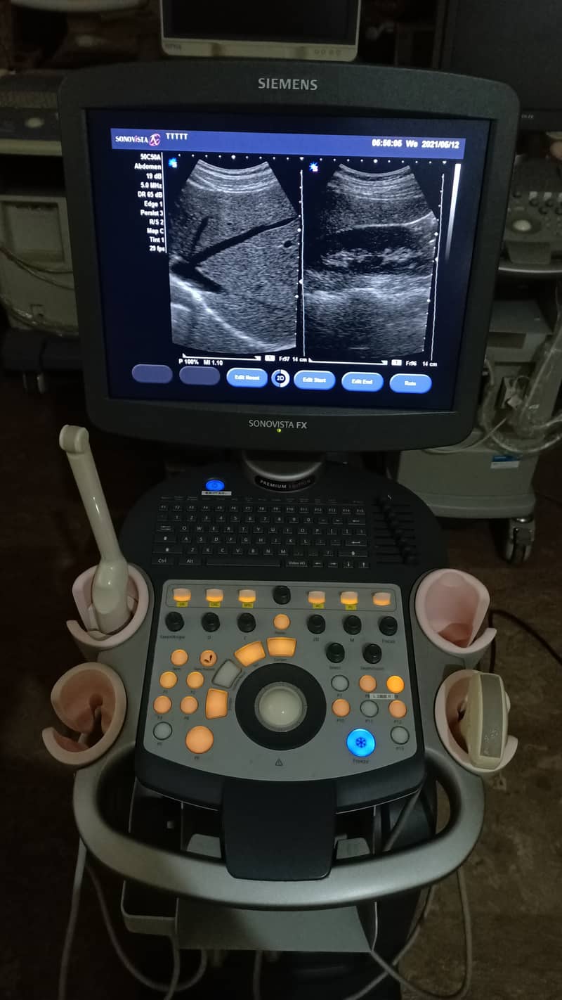 Siemens Sonovista FX Premium Edition Color Doppler Ultasound Machine 8