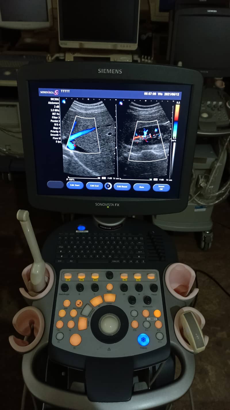 Siemens Sonovista FX Premium Edition Color Doppler Ultasound Machine 9