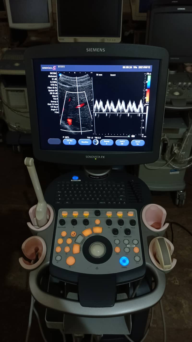 Siemens Sonovista FX Premium Edition Color Doppler Ultasound Machine 10