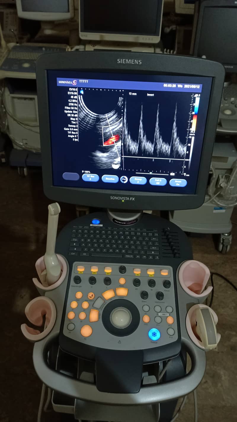 Siemens Sonovista FX Premium Edition Color Doppler Ultasound Machine 12