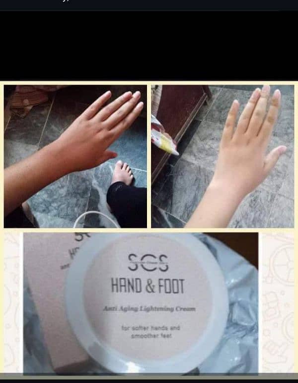 hand and feet whitening cream 1