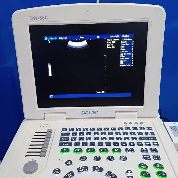 15 Saal chalny wali Branded Digital Advanced Dawei, Ultrasound Machine 4