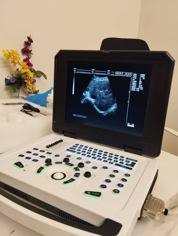 DIGITAL NOTE BOOK ULTRASOUND MACHINE MOST LATEST 2024 MODEL 3