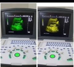 ULTRASOUND MACHINE / BATTERY OPRATED / NOVADEX Novadex C7 DIGITAL HD