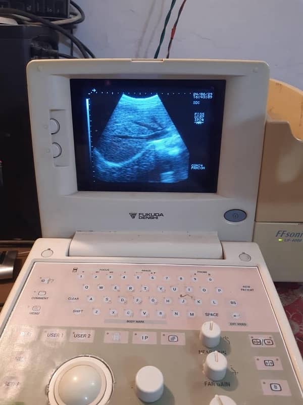 Fukuda Denshi UF 40000 ultrasound machine for sale 0