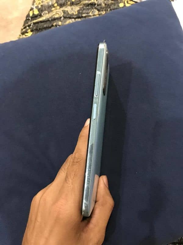 Xiaomi Redmi note 11 3