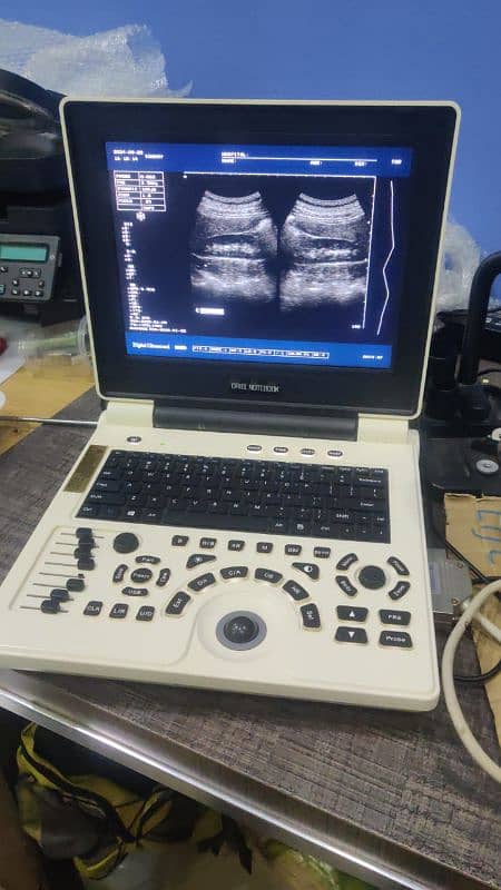 Stock of All types of ultrasound machines available 03179711119 5