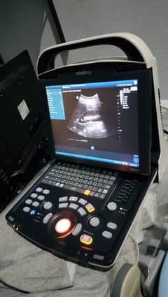 ultrasound