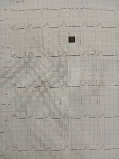 TEACH CARDIAC ECG READING: ONLINE, PART-TIME