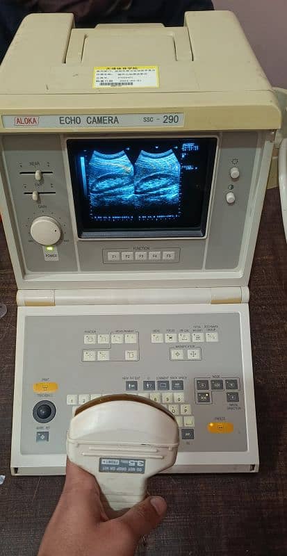 Japanese & Chaina Ultrasound Machines 3