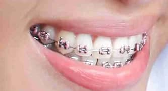 need female qulified dental technician for clinic 0