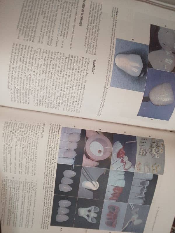 Contemporary Fixed prosthodontics by Rosentiel 2