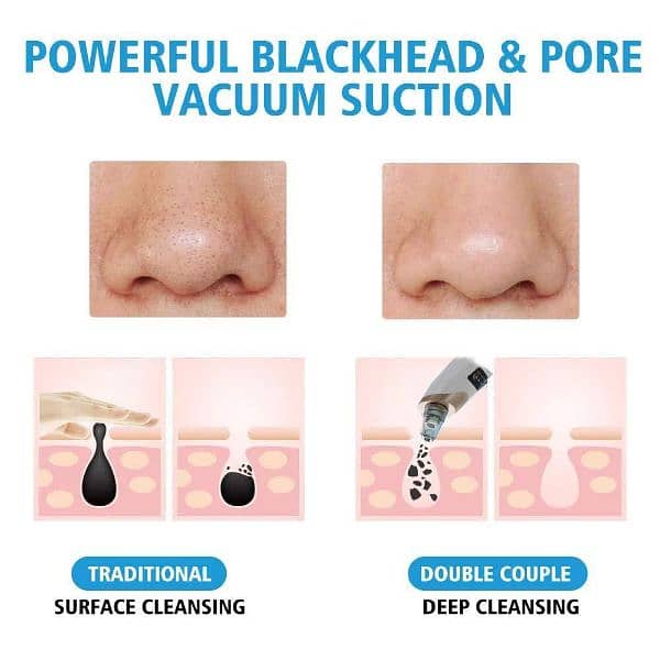 Portable Blackhead Pore Cleaner 2