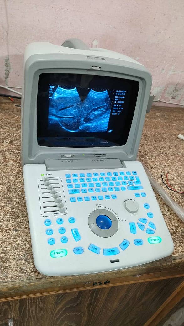 used chinese ultrasound machine available in low price 11