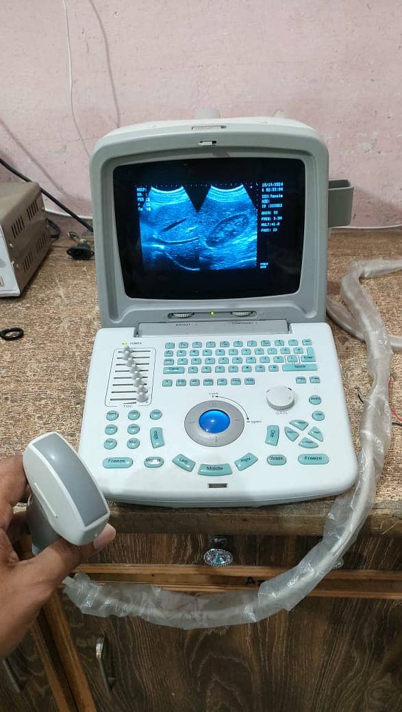 used chinese ultrasound machine available in low price 12