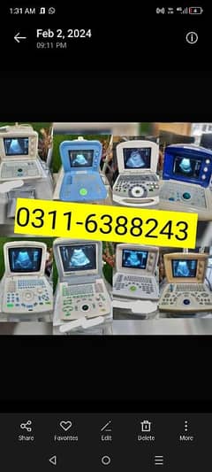 Japanese & Chaina Ultrasound Machines