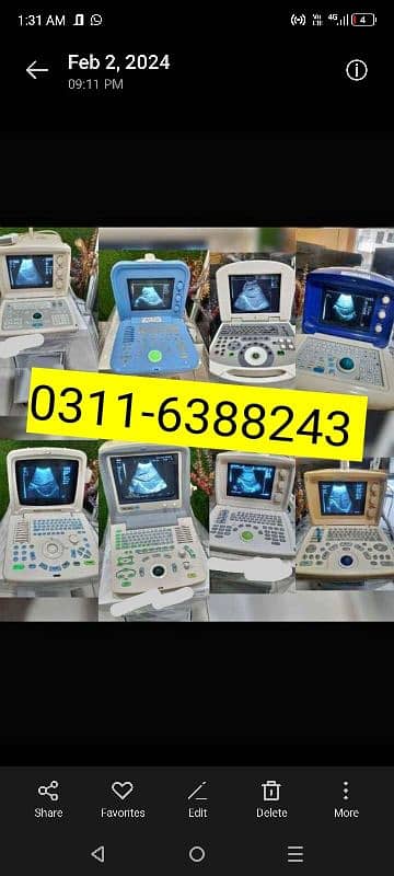 Japanese & Chaina Ultrasound Machines 0