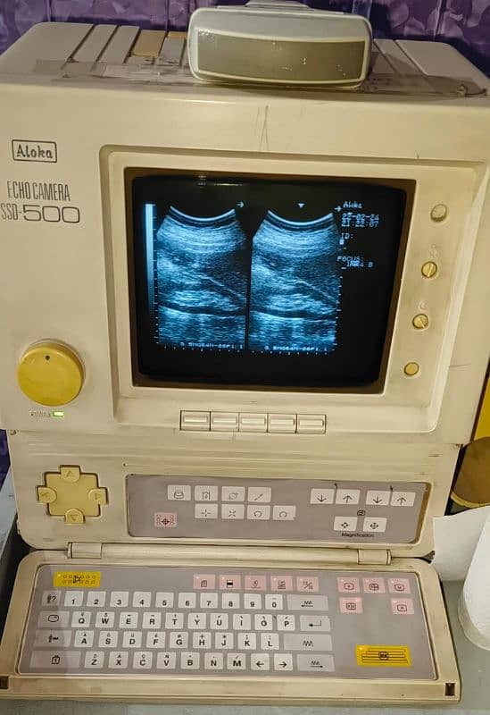 Mobile Troly and Ultrasound machines for Sale 5