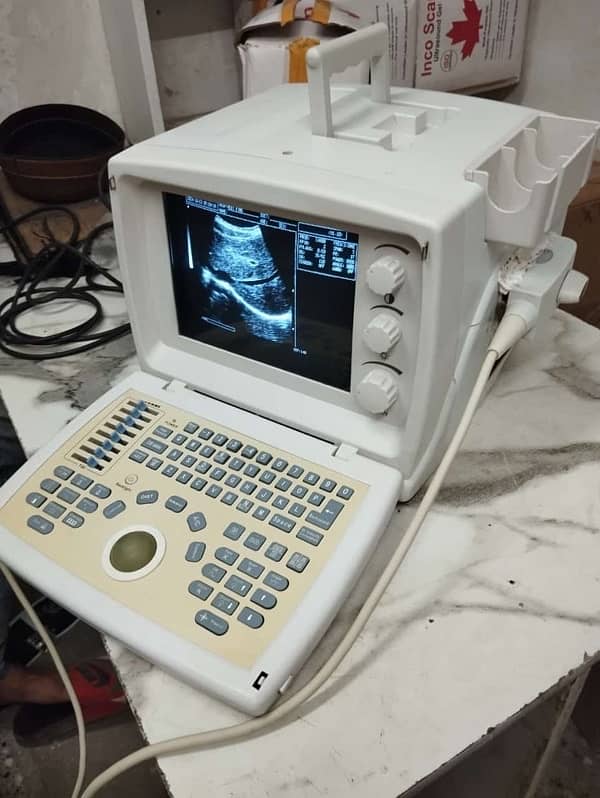 Novadex Ultrasound Machine 2