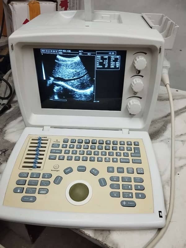 Novadex Ultrasound Machine 3