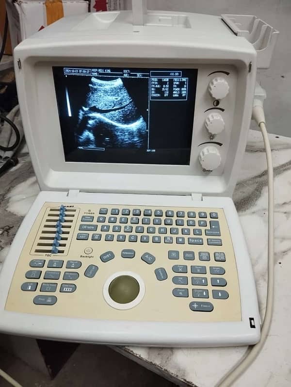 Novadex Ultrasound Machine 4