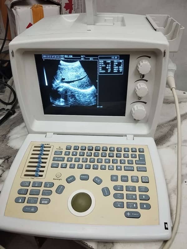 Novadex Ultrasound Machine 5