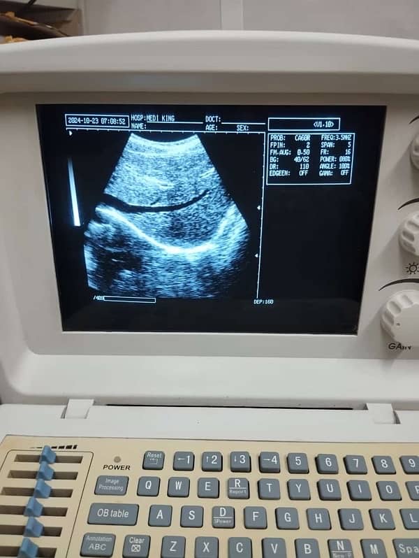 Novadex Ultrasound Machine 7