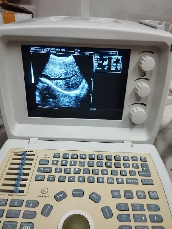 Novadex Ultrasound Machine 8