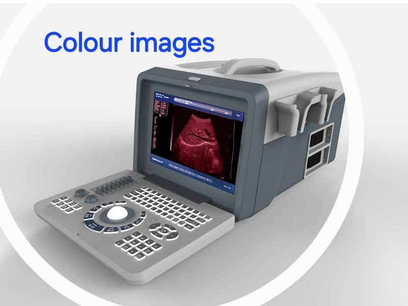 NOVADEX N3 PLUS DIGITAL ULTRASOUND MACHINE ASAN IQSAT PR HASIL KRAIN 3