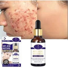 Aichun Beauty Medical Formula Anti-acne Whitening Facial Serum-30ml. 0