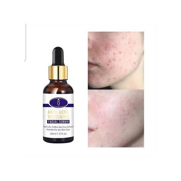 Aichun Beauty Medical Formula Anti-acne Whitening Facial Serum-30ml. 1