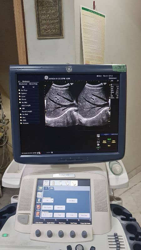 GE Logiq E9 imported ultrasound machine 2