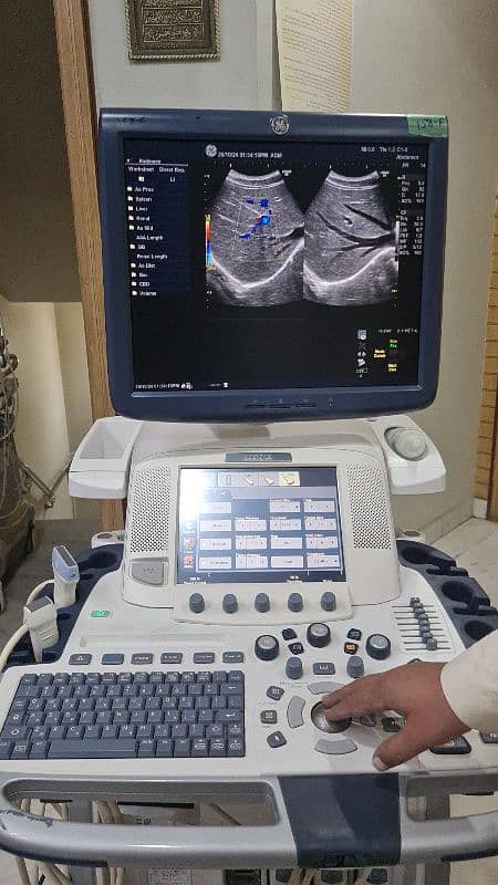 GE Logiq E9 imported ultrasound machine 3