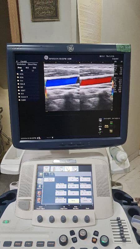 GE Logiq E9 imported ultrasound machine 4