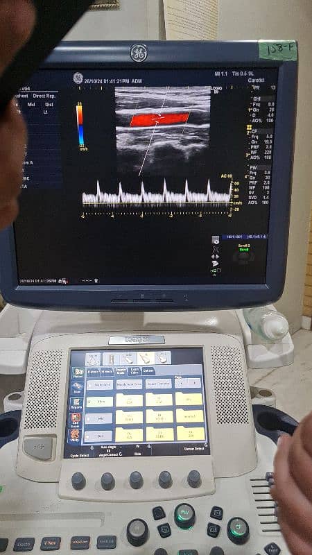 GE Logiq E9 imported ultrasound machine 7