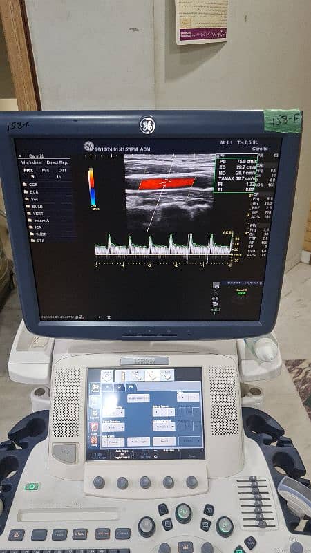 GE Logiq E9 imported ultrasound machine 8