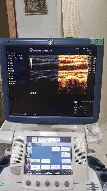 GE Logiq E9 imported ultrasound machine 9