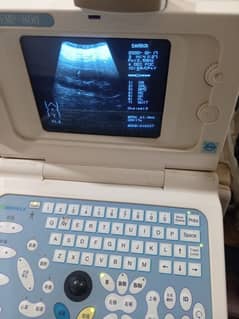 portable ultrasound machine / color doppler for sale 0