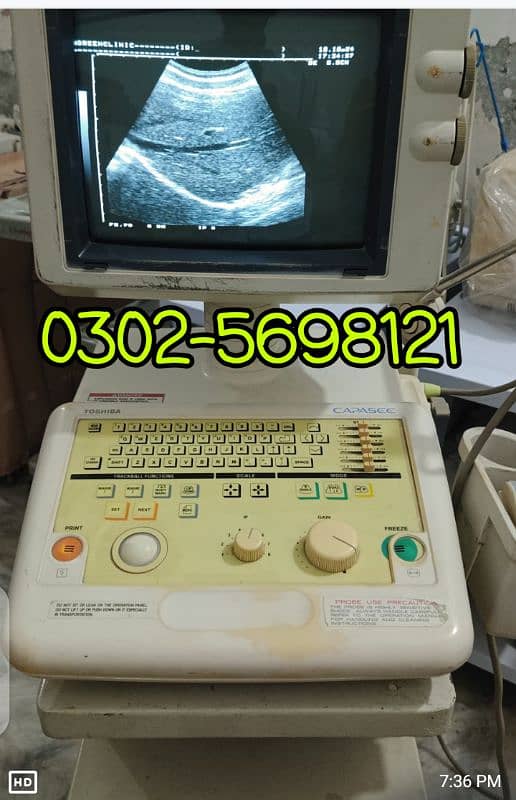 portable ultrasound machine / color doppler for sale 7